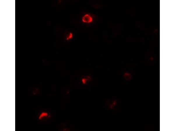 Immunofluorescence of Pellino 1