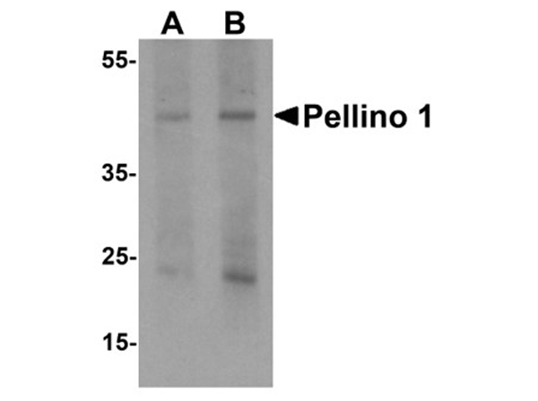 Western blot analysis of Pellino 1