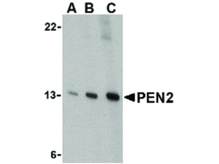 Western Blot of PEN2 Antibody