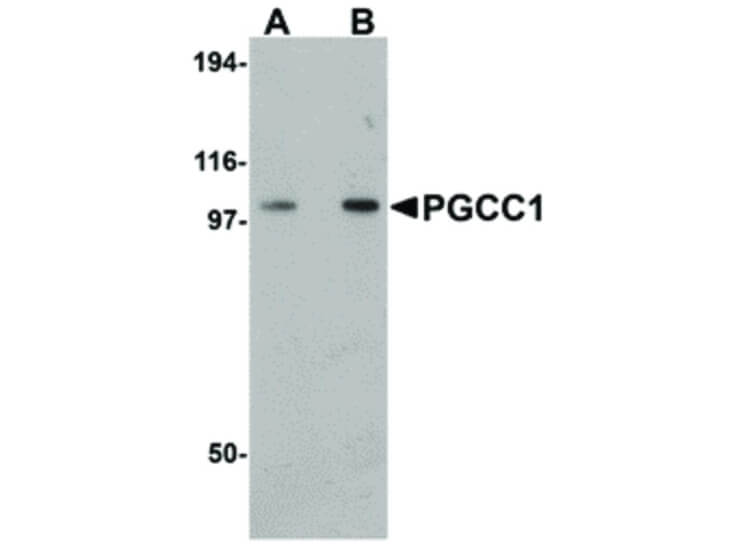 Western Blot of PGCC1 Antibody