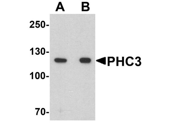 Western blot of PHC3