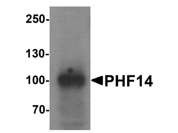Western blot of PHF14
