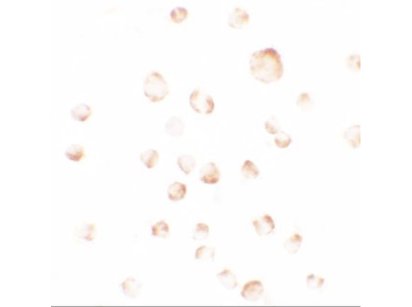 Immunocytochemistry of PHLPP1
