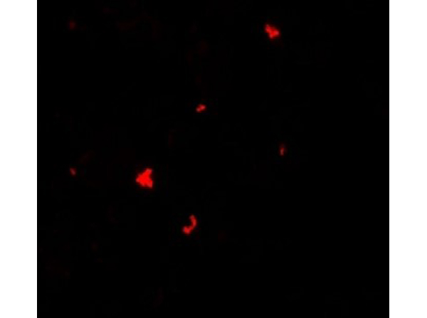 Immunofluorescence of PHLPP1