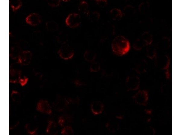 Immunofluorescence of PHLPP2