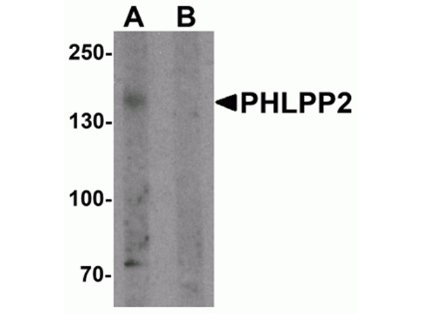 Western blot analysis of PHLPP2