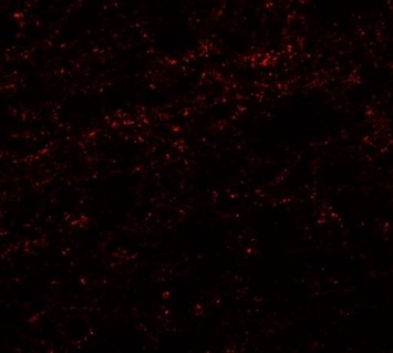 Immunofluorescence of PHOX2A
