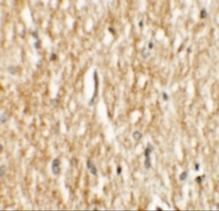 Immunohistochemistry of PHOX2A