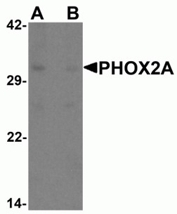 Western blot analysis of PHOX2A