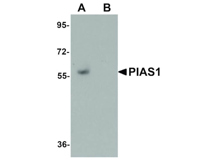 Western Blot of PIAS1 Antibody