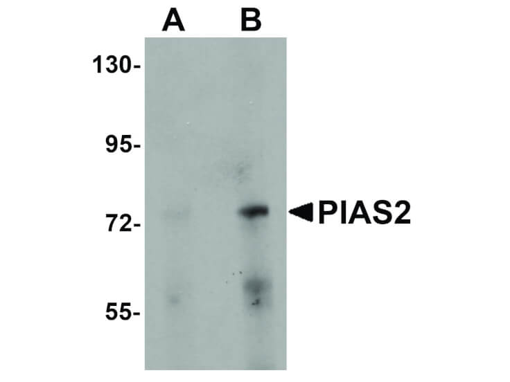 Western Blot of PIAS2 Antibody
