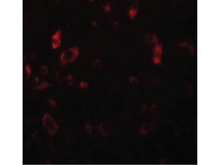 Immunofluorescence of PIAS2 Antibody