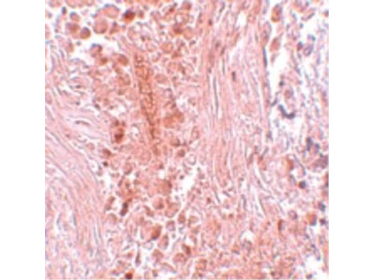 Immunohistochemistry of PIAS3 Antibody