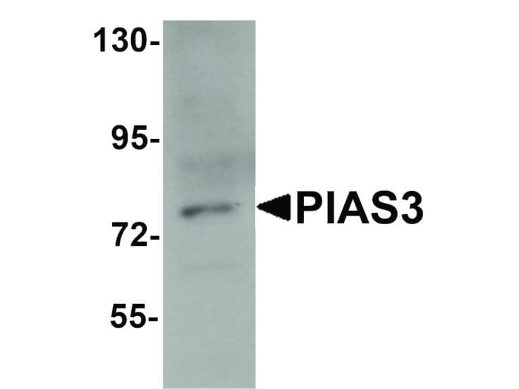 Western Blot of PIAS3 Antibody