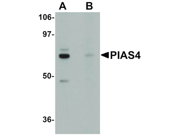 Western Blot of PIAS4 Antibody