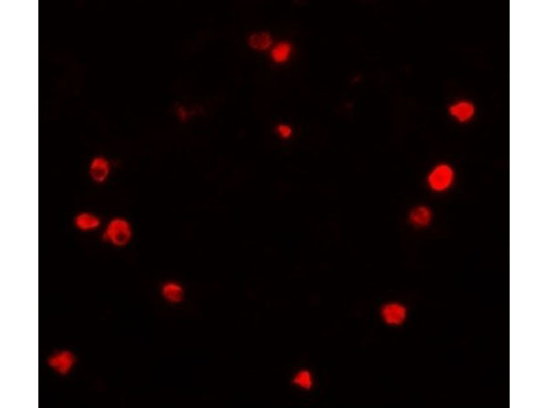 Immunofluorescence of PIBF1