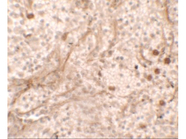 Immunohistochemistry of PIBF1