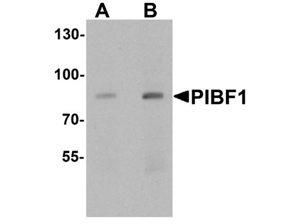Western blot analysis of PIBF1