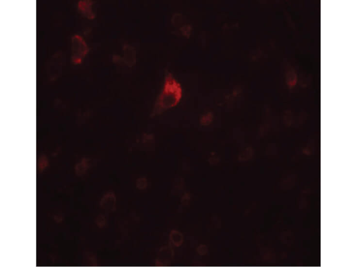 Immunofluorescence of PICALM Antibody