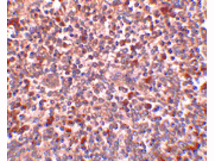 Immunohistochemistry of PIG-Y Antibody