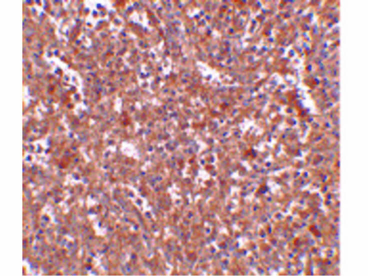 Immunohistochemistry of PIG-Y Antibody