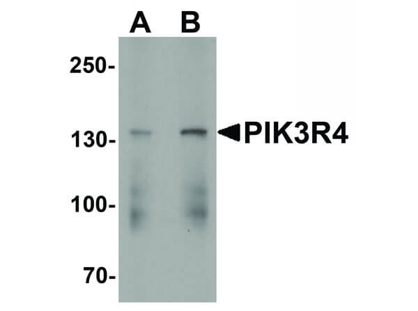Western Blot of PIK3R4 Antibody