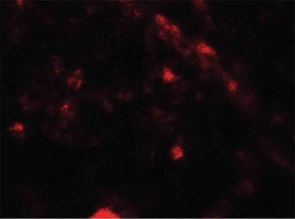 Immunofluorescence of PIK3R4 Antibody