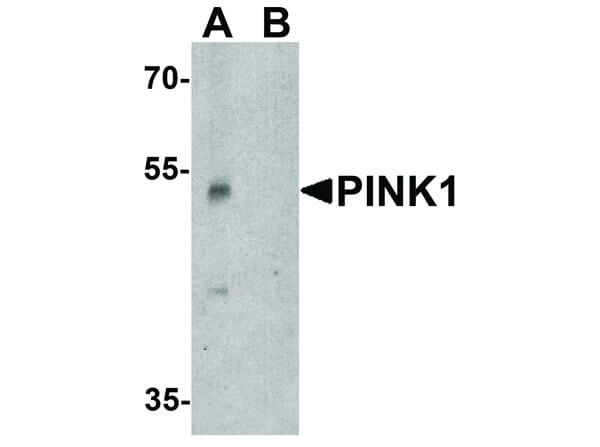 Western Blot of PINK1 Antibody