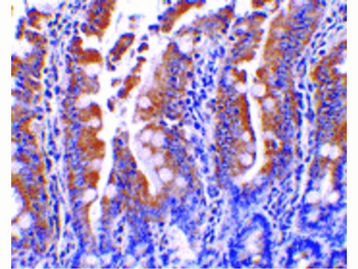 Immunohistochemistry of PIST Antibody