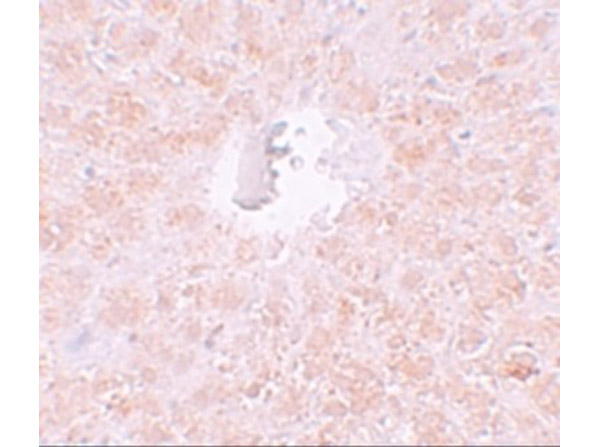 Immunohistochemistry of PIWI-L1