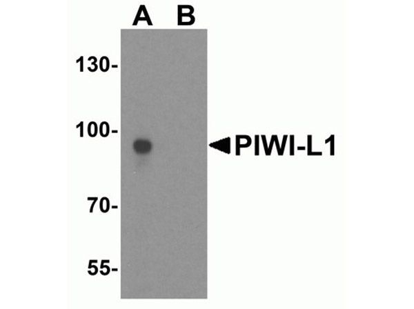 Western blot analysis of PIWI-L1