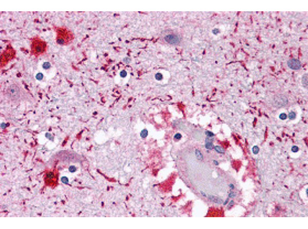 Immunohistochemistry of PIWI-L2