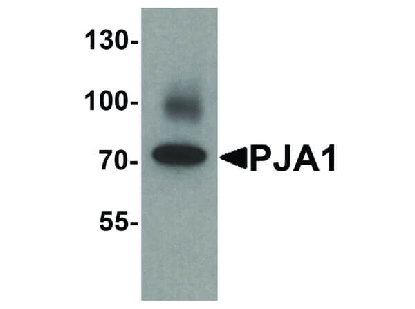 Western Blot of PJA1 Antibody