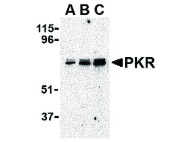 Western Blot of PKR Antibody