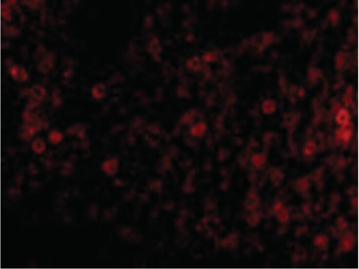Immunofluorescence of PKR Antibody