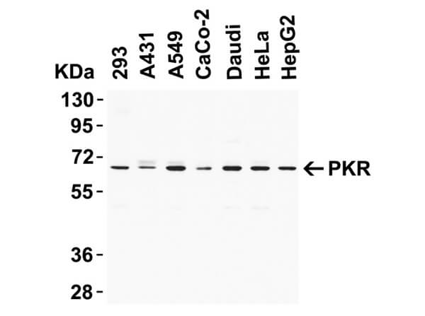 Western Blot of Rabbit Anti-PKR Antibody