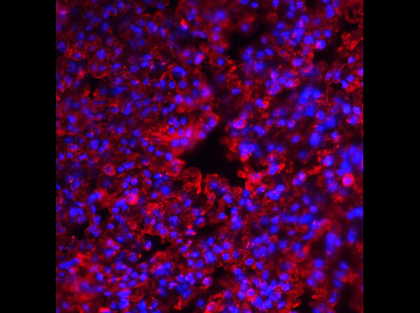Immunofluorescence of Rabbit Anti-PKR Antibody