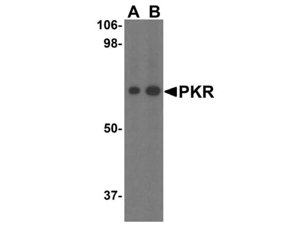 Western Blot of PKR antibody