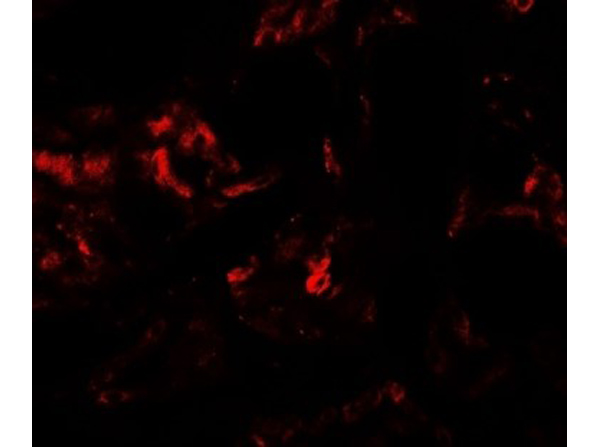 Immunofluorescence of PLA1A