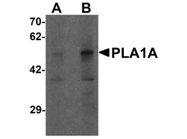 Western blot analysis of PLA1A