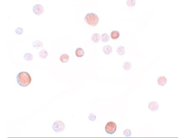 Immunocytochemistry of PLAC1