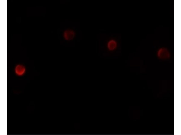 Immunofluorescence of PLAC1