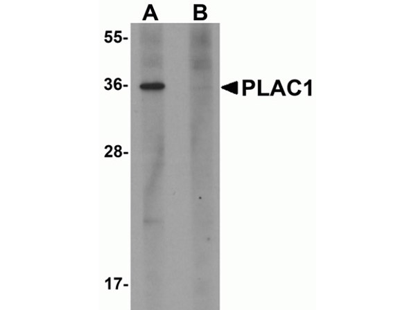 Western blot of PLAC1