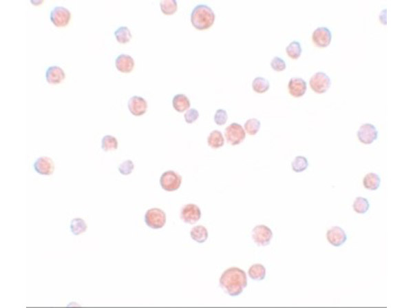 Immunocytochemistry of PLAC2