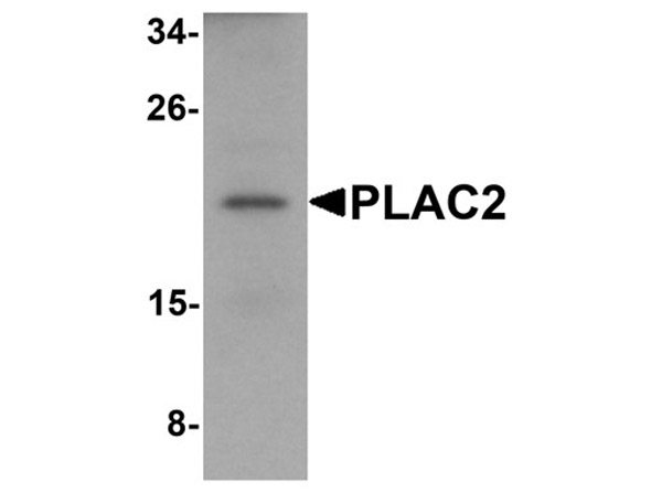 Western blot of PLAC2