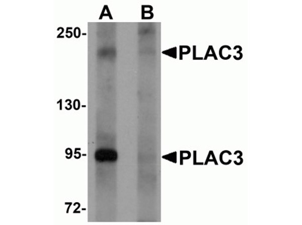 Western blot of PLAC3