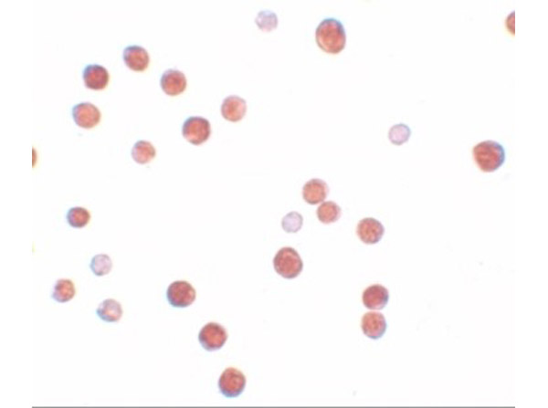 Immunocytochemistry of PLAC4