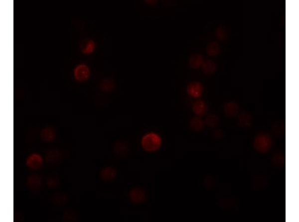 Immunofluorescence of PLAC4