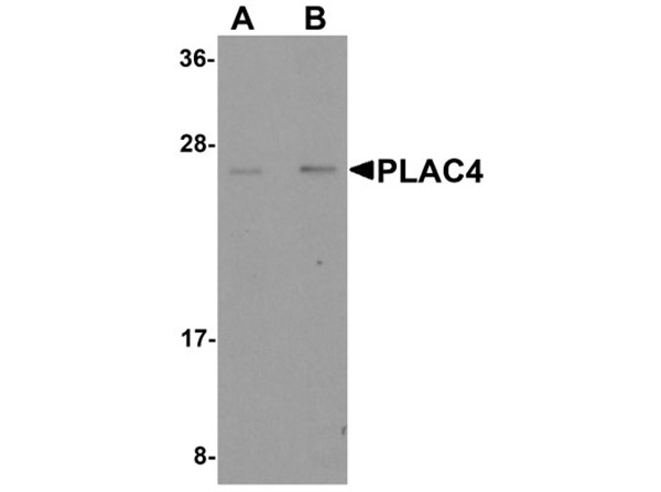 Western blot of PLAC4