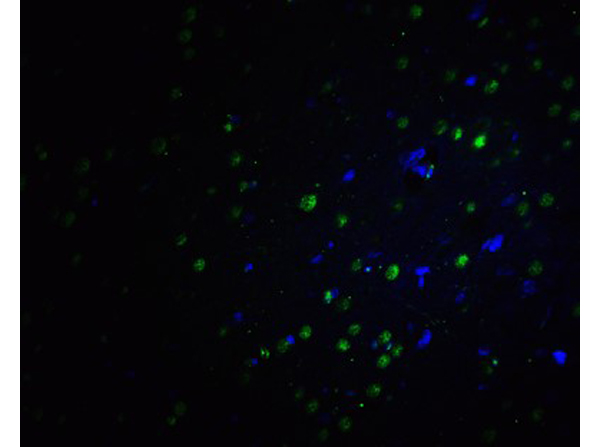 Immunofluorescence of PLAGL2
